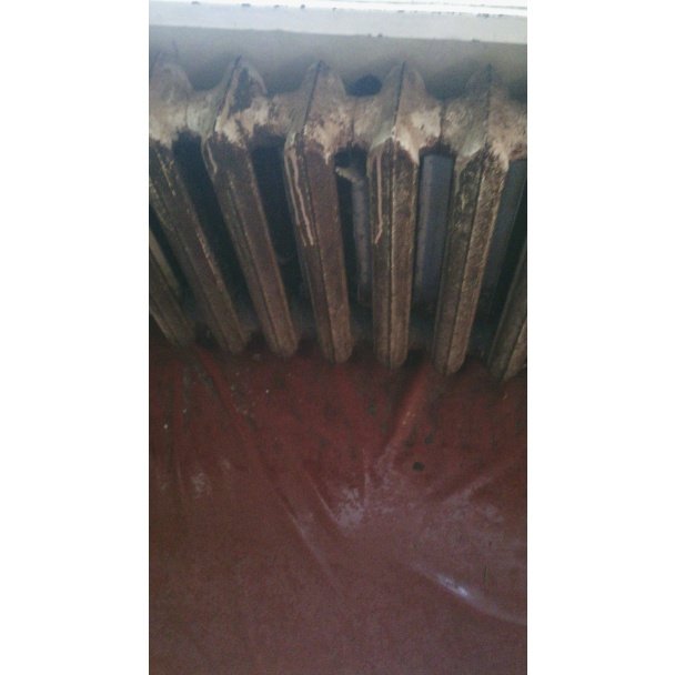 Холодна палата, стіни вкриті грибком, жахливий сморід, – жінка поскаржилась на умови в одній із лікарень області (ФОТО) – 08