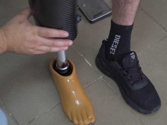 Брати-реабілітологи заснували на Закарпатті клініку та протезують військових – 07