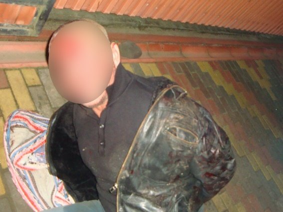 Лейтенанта поліції, якого поранив житель Рахівщини, прооперували – 01 Лейтенанта поліції, якого поранив житель Рахівщини, прооперували – 01