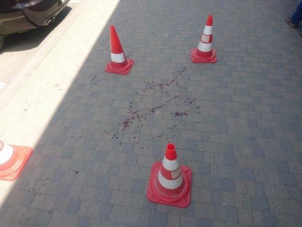 Жорстока бійка в Ужгороді: одну людину поранено ножем в шию – 04 Жорстока бійка в Ужгороді: одну людину поранено ножем в шию – 04