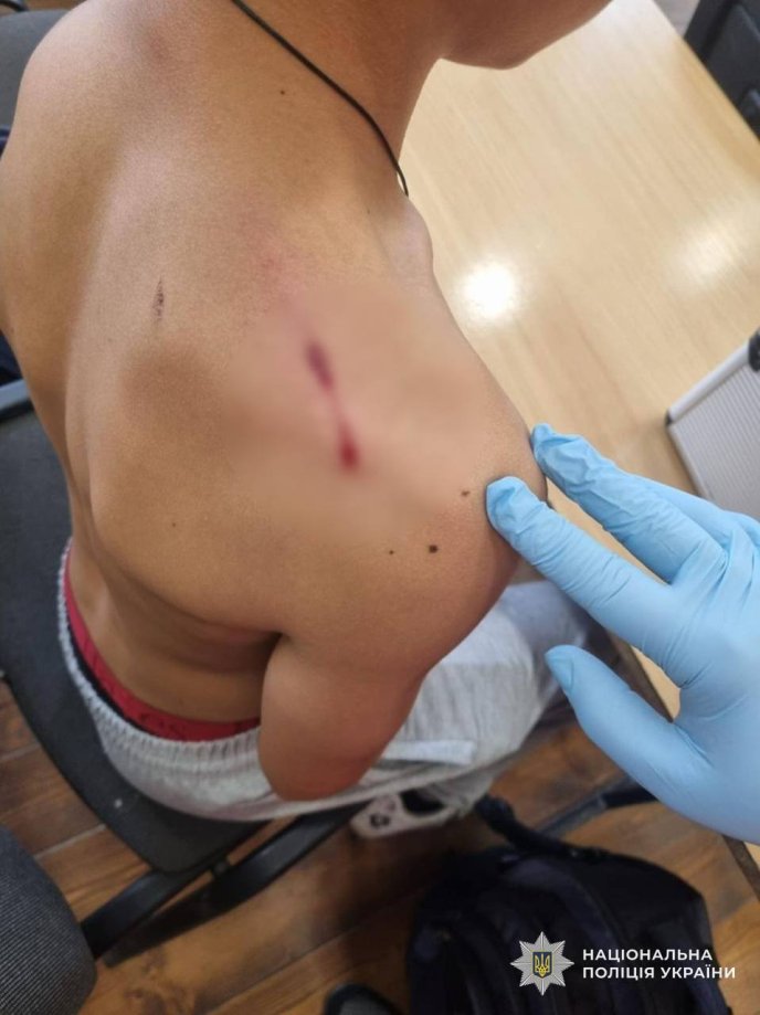 На Закарпатті учень під час уроку дістав пістолет і вистрілив в однокласника – 03