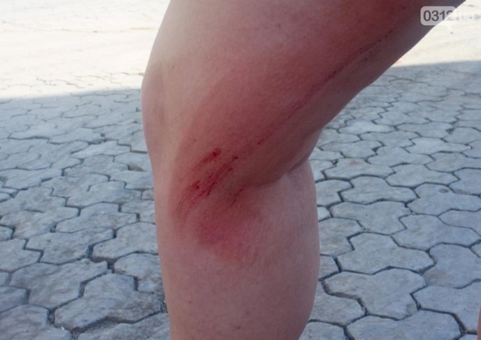 У центрі Ужгорода дівчина провалилася у люк – 01