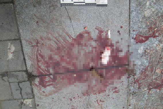 В Ужгороді вночі сталась стрілянина, внаслідок якої постраждав житель Мукачівщини – 03