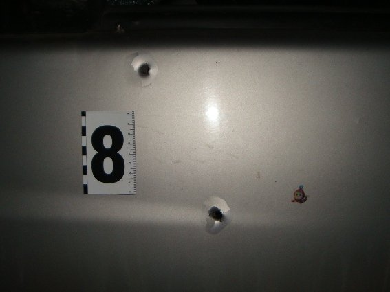 Лейтенанта поліції, якого поранив житель Рахівщини, прооперували – 04 Лейтенанта поліції, якого поранив житель Рахівщини, прооперували – 04