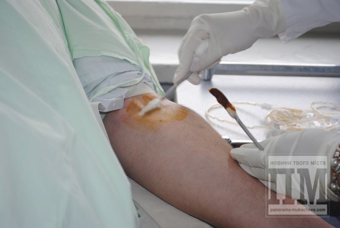 Священнослужителі УПЦ КП здали свою кров для закарпатських бійців АТО (ФОТО) – 01