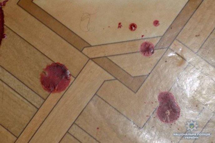 Закарпатка ледь не вбила чоловіка. Зараз він у реанімації – 02