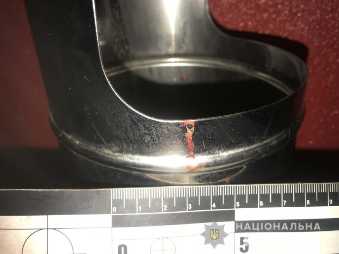 Закарпатець напав на хлопця у розважальному закладі – 02 Закарпатець напав на хлопця у розважальному закладі – 02