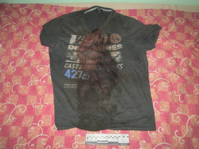 Нічна стрілянина в Ужгороді: потерпілий заявляє про напад у Боздоському парку – 03