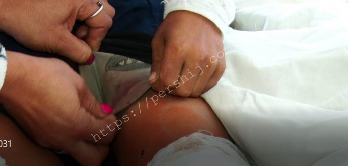 Хлопчик побачив кров на ногах: подробиці випадку, який трапився із дітьми – 01