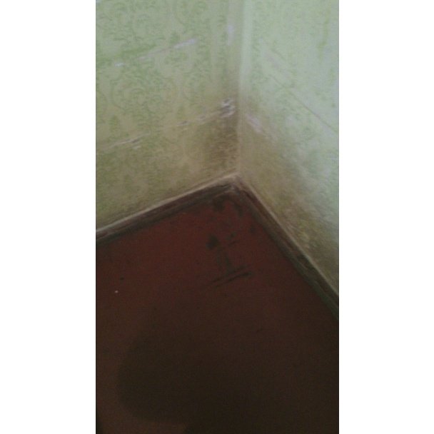 Холодна палата, стіни вкриті грибком, жахливий сморід, – жінка поскаржилась на умови в одній із лікарень області (ФОТО) – 04