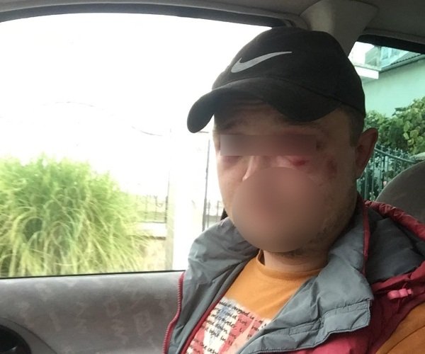 Грибні розбірки по-міжгірськи: б’ють усім селом, можуть і машину спалити – 01