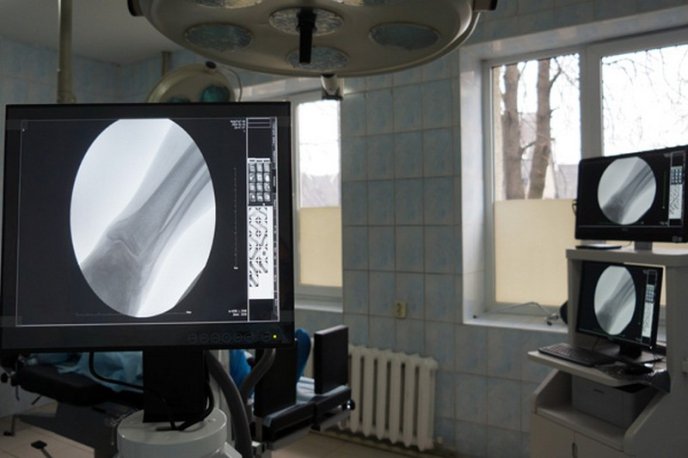 Тячівська райлікарня №1 отримала сучасну рентген-систему – 02