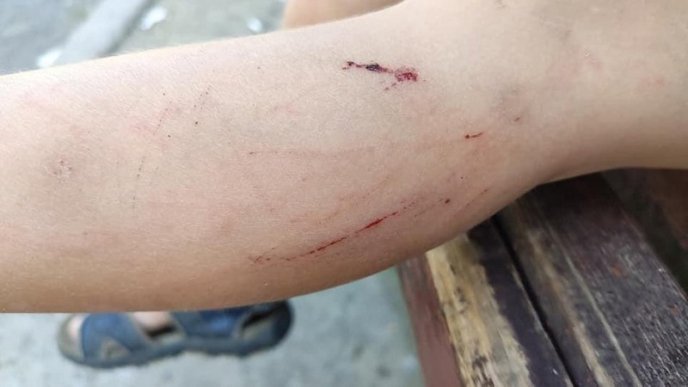 У центральній частині Ужгорода дитина провалилась в яму – 03 У центральній частині Ужгорода дитина провалилась в яму – 03