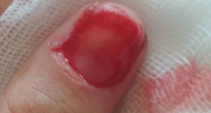 Після поїздки у маршрутці дівчина опинилася в лікарні – 02