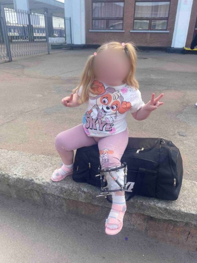 Процес лікування і реабілітації тривав 9 місяців / фото: Закарпатська обласна дитяча лікарня