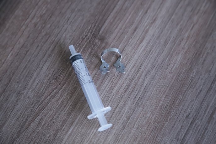 Стоматологічний інструмент у носоглотці: 8-річного хлопчика врятували лікарі – 01