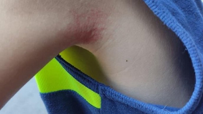 У центральній частині Ужгорода дитина провалилась в яму – 02 У центральній частині Ужгорода дитина провалилась в яму – 02