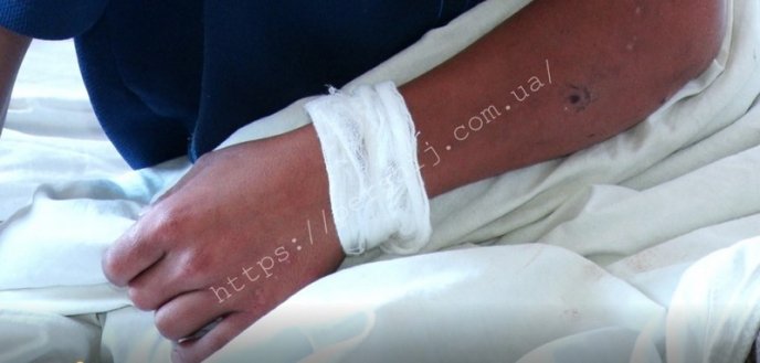 Хлопчик побачив кров на ногах: подробиці випадку, який трапився із дітьми – 04