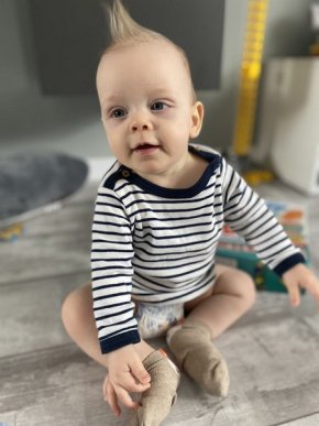 Восьмимісячному хлопчику з Мукачева потрібна допомога у боротьбі важкою недугою – 01