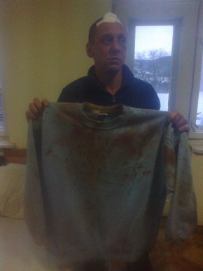 На Свалявщині група осіб зухвало побила добровольців батальйону "Донбас" – 02 На Свалявщині група осіб зухвало побила добровольців батальйону "Донбас" – 02