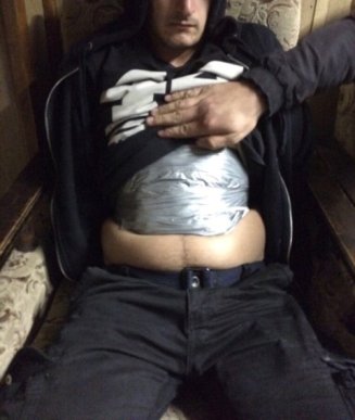 Собака знайшла у чоловіка наркотики, які той примотав скотчем до тіла – 02