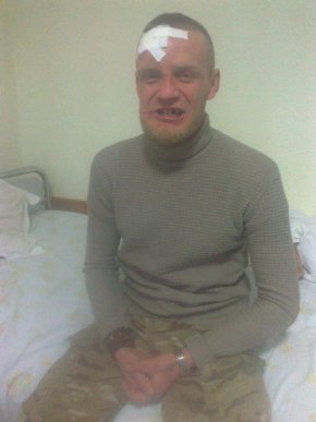 На Свалявщині група осіб зухвало побила добровольців батальйону "Донбас" – 03 На Свалявщині група осіб зухвало побила добровольців батальйону "Донбас" – 03