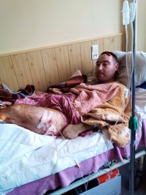 Під час вечірньої стрілянини зловмисники отримали поранення в живіт і ноги (ФОТО) – 02