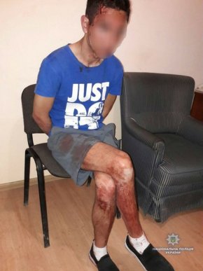 Вбивство на Великдень: на Ужгородщині зарізали молодого чоловіка – 02 Вбивство на Великдень: на Ужгородщині зарізали молодого чоловіка – 02