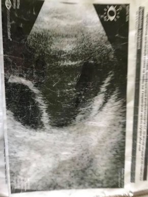 У закарпатської вчительки виявили важку недугу. Небайдужих просять допомогти – 04