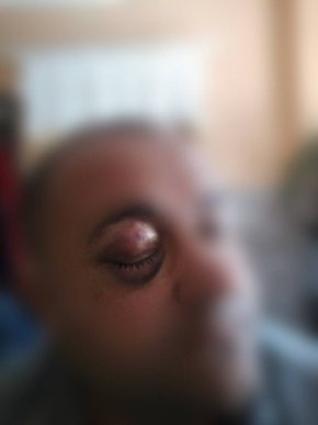 В області жорстоко побили депутата – 01