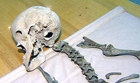 Біля Верхнього Коропця знайшли скелет невідомого чоловіка