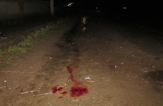 П’яний водій на “Фольксвагені” збив пішохода (ФОТО)