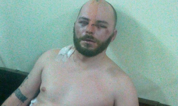 ФОТО: Правий сектор Бійця ПС, якому стало погано у залі суду, забрала "швидка"