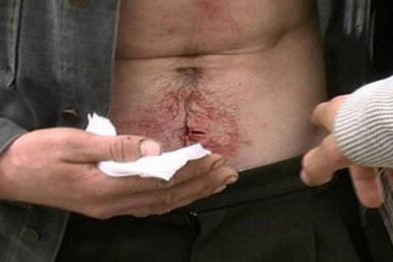 Під час гулянки ужгородець влучив ножем у живіт брата Під час гулянки ужгородець влучив ножем у живіт брата
