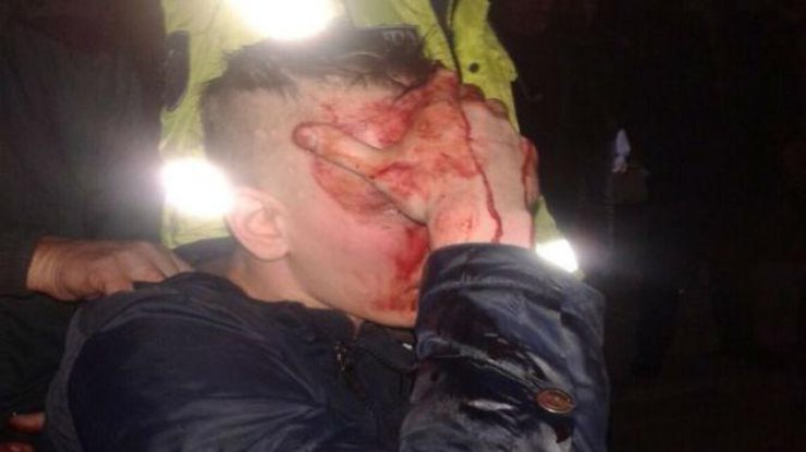 В Чинадієві біля бару невідомі побили чоловіка. У потерпілого важка травма голови В Чинадієві біля бару невідомі побили чоловіка. У потерпілого важка травма голови