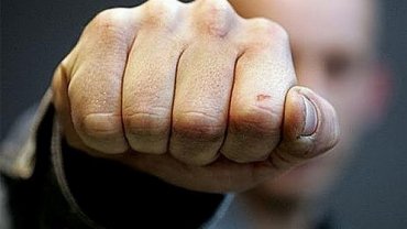 На вулиці Капушанській в Ужгороді жорстоко побили чоловіка На вулиці Капушанській в Ужгороді жорстоко побили чоловіка