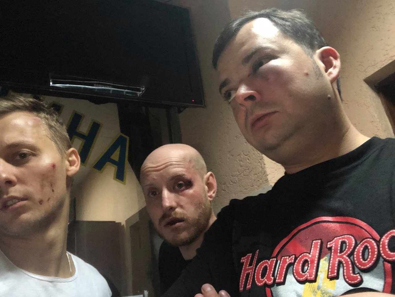 У Києві побили сина нардепа із Закарпаття У Києві побили сина нардепа із Закарпаття
