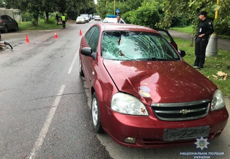 Помер чоловік, якого в Ужгороді збив автомобіль Помер чоловік, якого в Ужгороді збив автомобіль