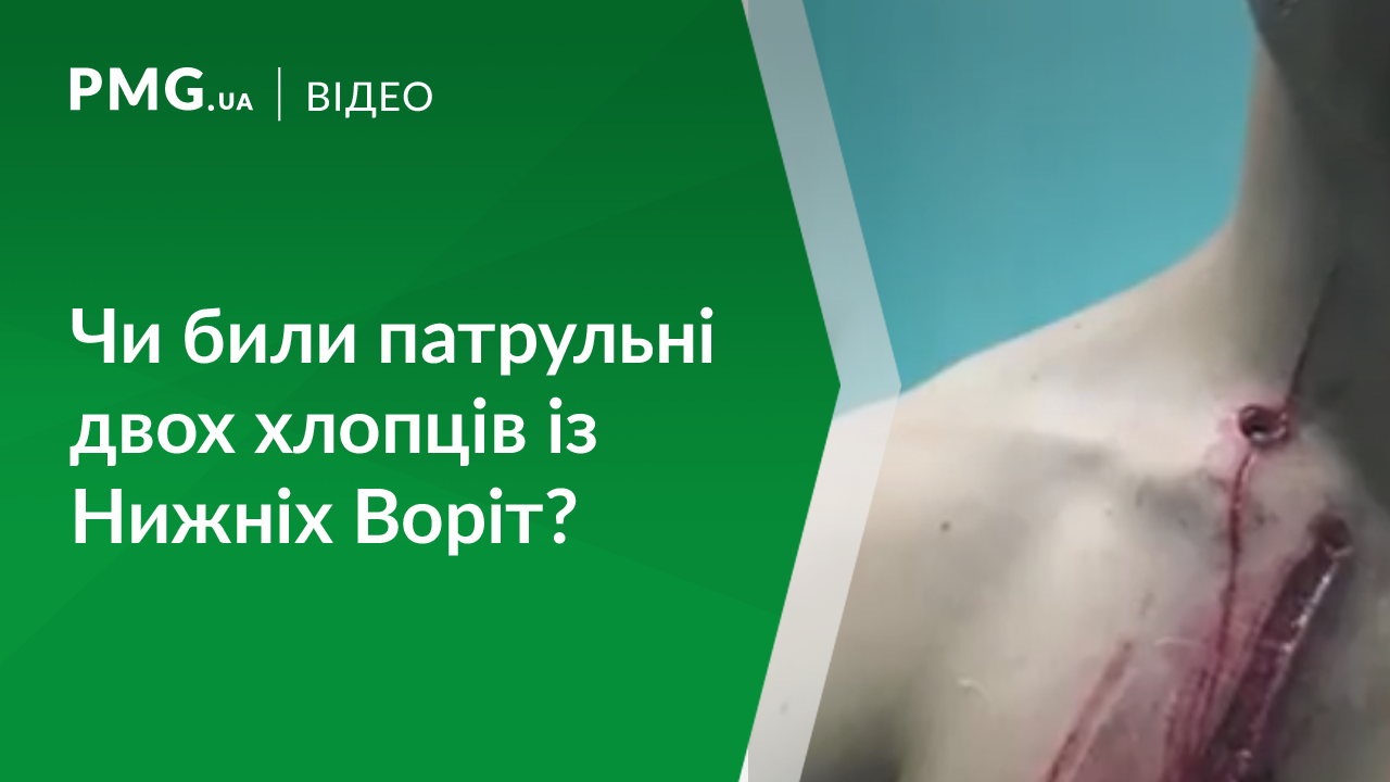 Скандал із патрульними на Закарпатті: чи дійсно вони били хлопців? Скандал із патрульними на Закарпатті: чи дійсно вони били хлопців?