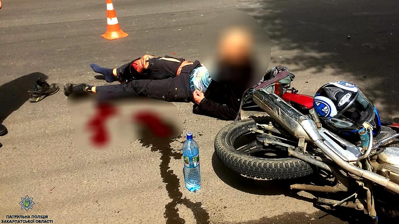 У хлопця була сильна кровотеча: подробиці та фото ДТП в Ужгороді У хлопця була сильна кровотеча: подробиці та фото ДТП в Ужгороді