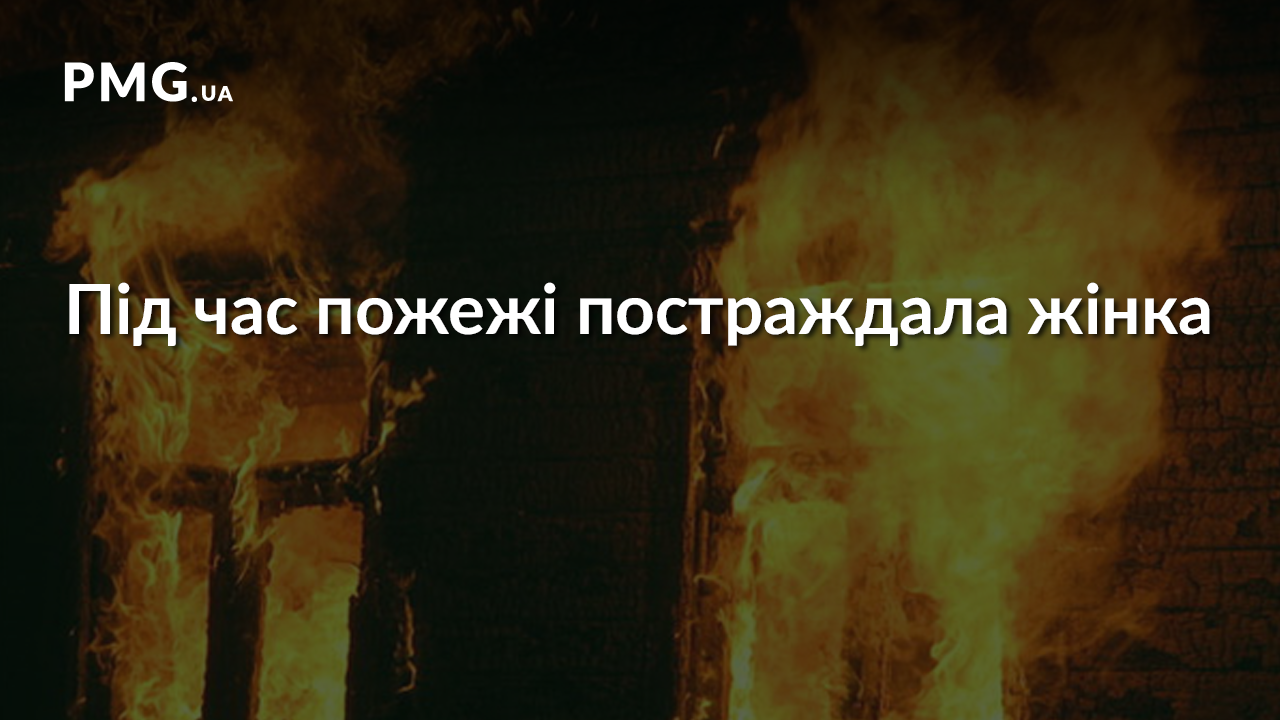 Під час пожежі жінка отримала жахливі опіки Під час пожежі жінка отримала жахливі опіки