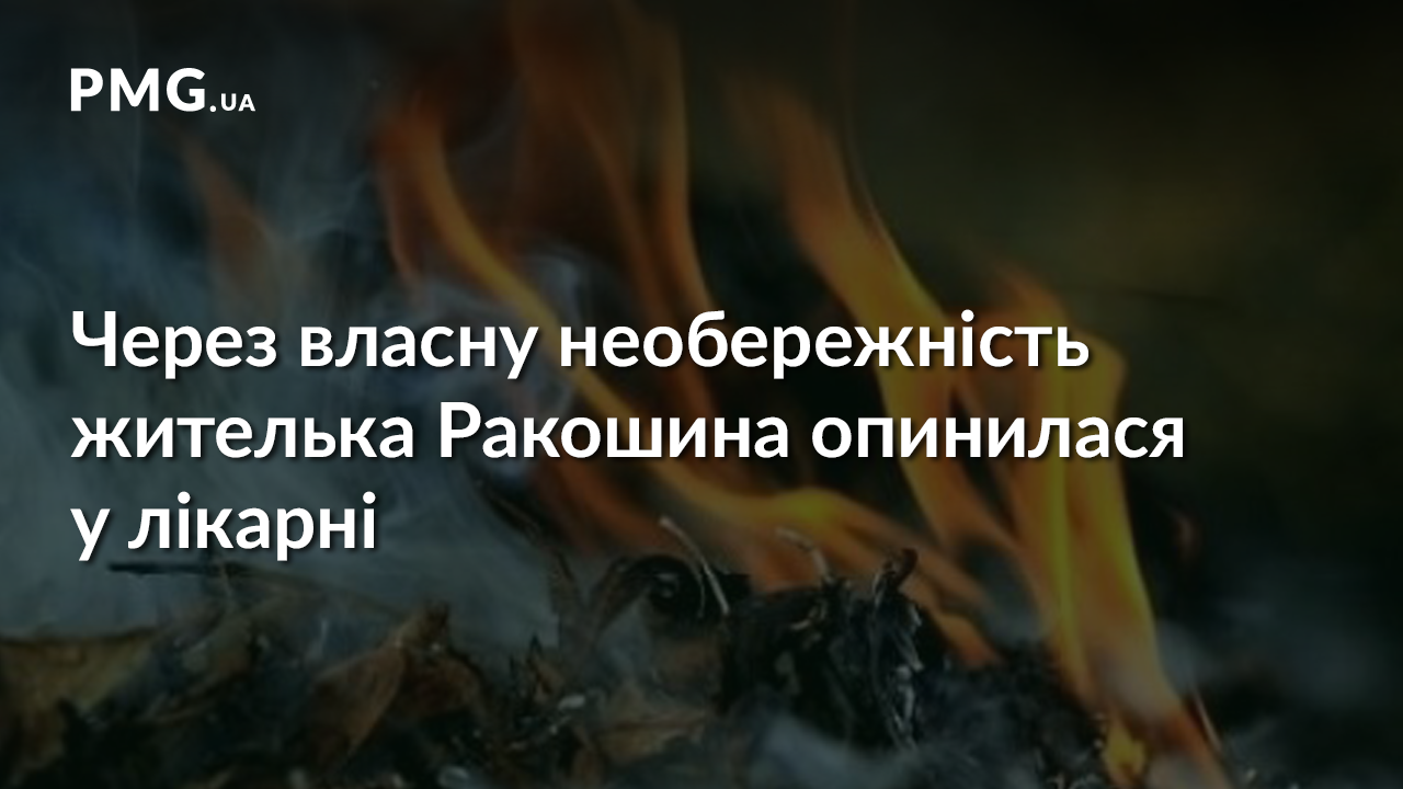 На Мукачівщині молода жінка обпекла ноги На Мукачівщині молода жінка обпекла ноги