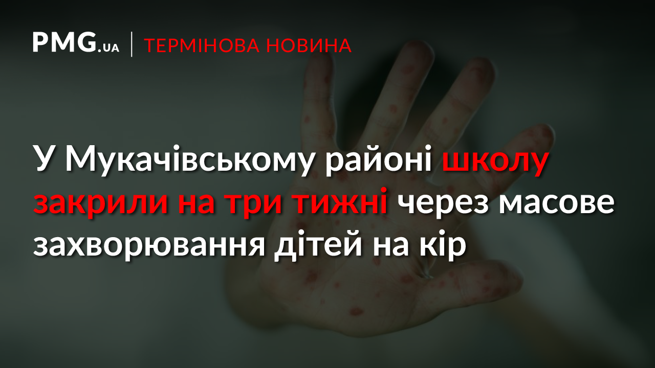 У селі на Мукачівщині виявлено масове захворювання дітей на кір. Школу закрили на три тижні У селі на Мукачівщині виявлено масове захворювання дітей на кір. Школу закрили на три тижні