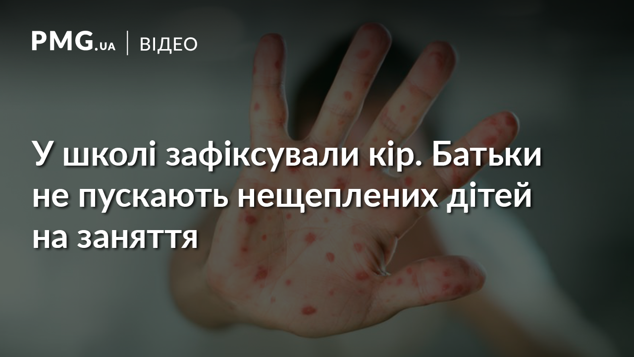 Кір у школі: нещеплені діти не ходять на заняття Кір у школі: нещеплені діти не ходять на заняття