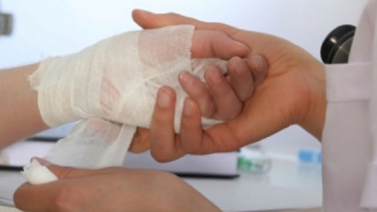 Нещасний випадок на Закарпатті: постраждала жінка У селі Великі Ком’яти на Виноградівщині вибухнула газоповітряна суміш. Постраждала літня жінка