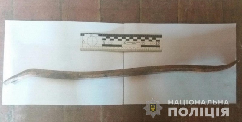 Кривавий конфлікт: чоловік в лікарні у важкому стані Кривавий конфлікт у селі Нижні Ремети: чоловік в Берегівській райлікарні у важкому стані