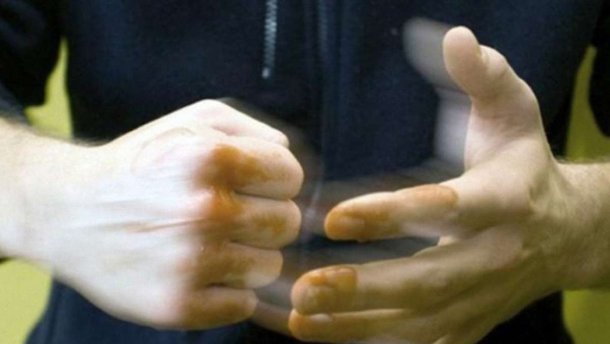 Переломи щелепи та носа, синці і садна по всьому тілу, — чим закінчився відпочинок для мешканців Тячівщини На Тячівщині невідомі побили двох чоловіків