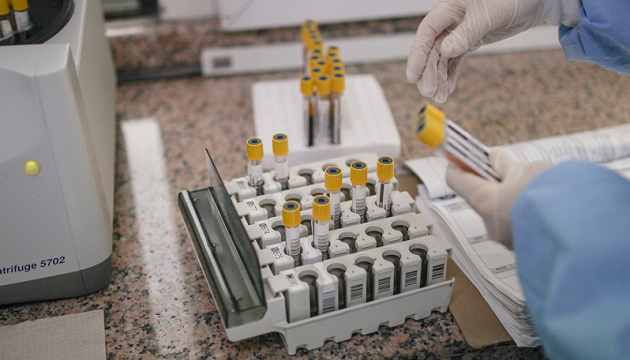 У Мукачеві п’ять нових випадків коронавірусу У Мукачеві п’ять нових випадків коронавірусу