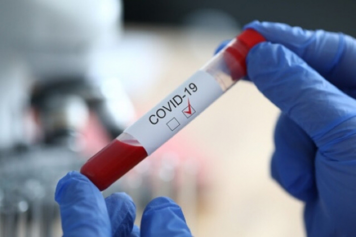 У Мукачеві побільшало хворих на COVID-19 У Мукачеві побільшало хворих на COVID-19