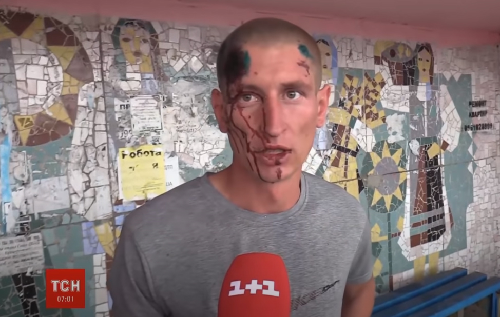"Я йому моргав фарами, сигналив. Він не реагував", – травмований водій фури розповів подробиці ДТП "Я йому моргав фарами, сигналив. Він не реагував", – травмований водій фури розповів подробиці ДТП